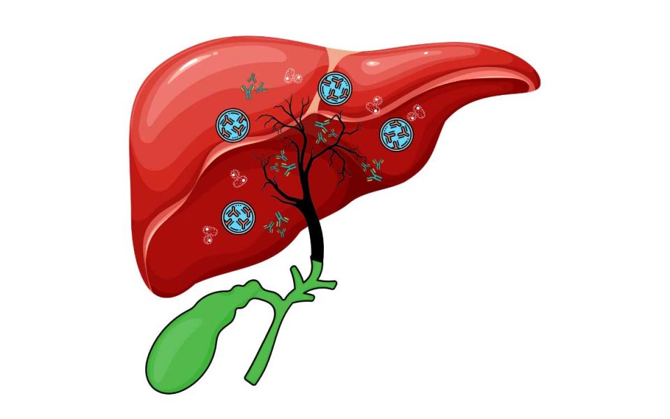 What is Primary Biliary Cholangitis?