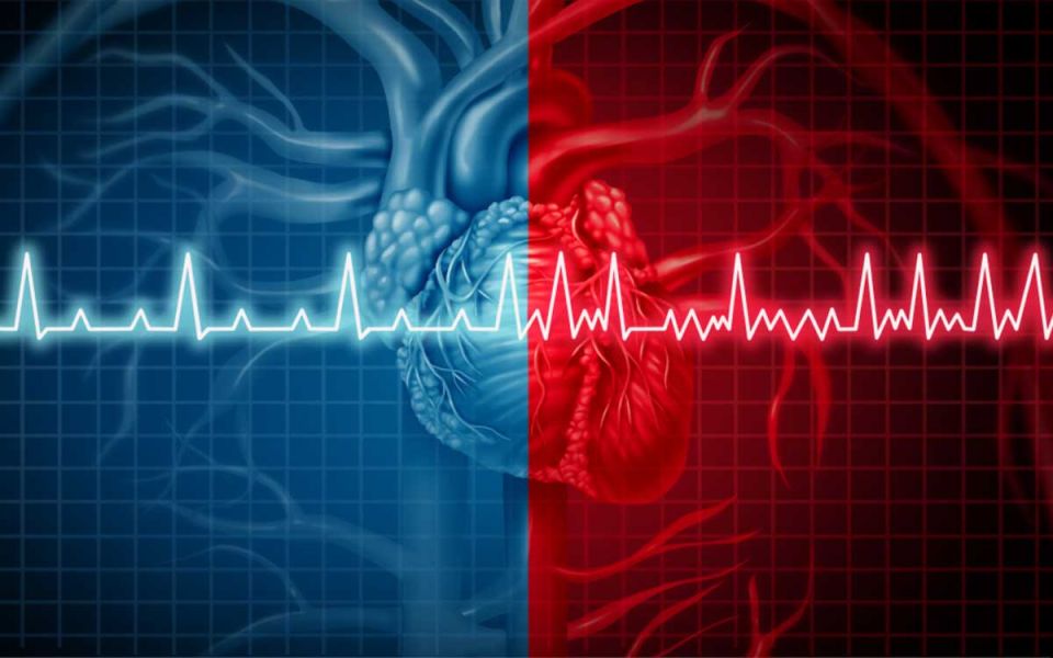 This Article Contains No Fibs About AFib
