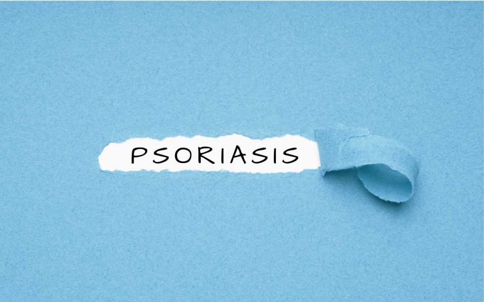 Biologics for Psoriasis & Psoriatic Arth...