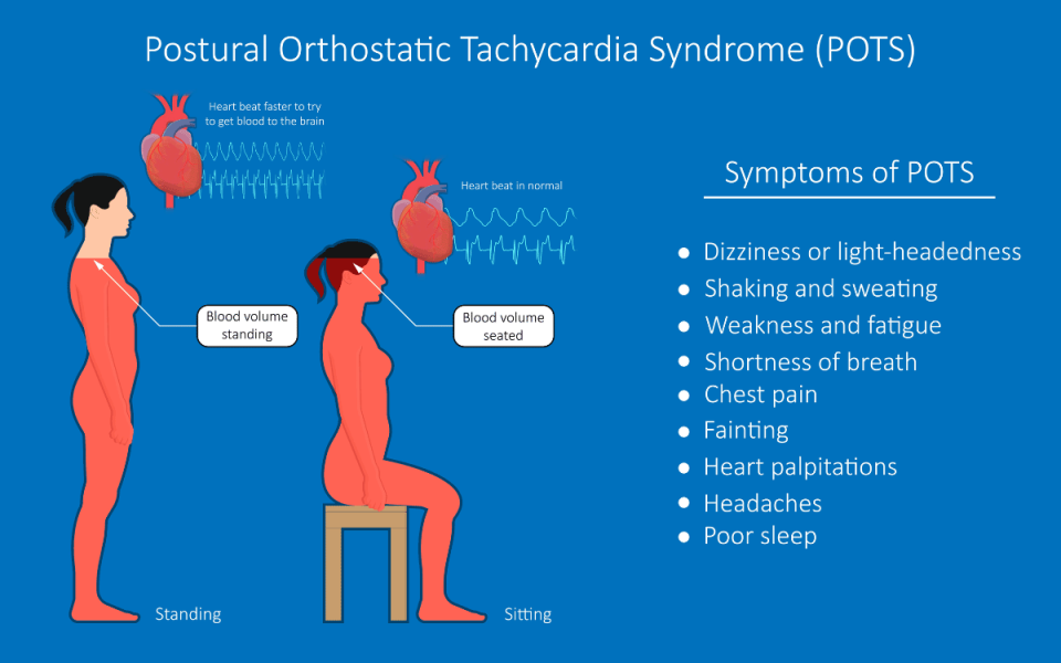 Navigating the Ups and Downs of POTS: Understanding Postural Orthostatic Tachycardia Syndrome