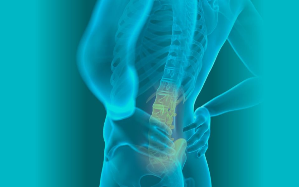 Low Back Pain: Lumbosacral Radiculopathy