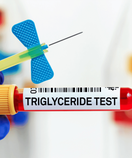 Mastering Triglyceride Management