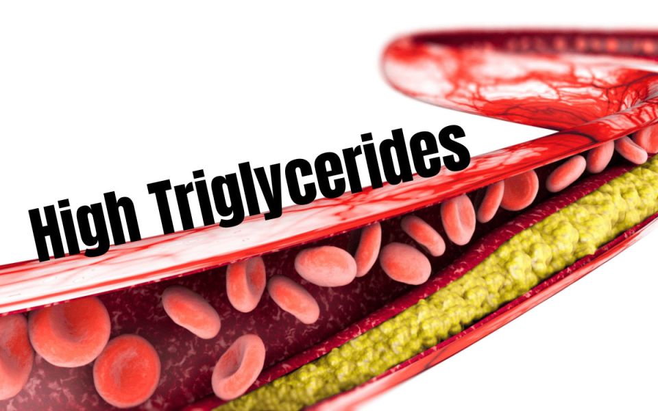 Jacksonville Doctor Talks About High Triglycerides