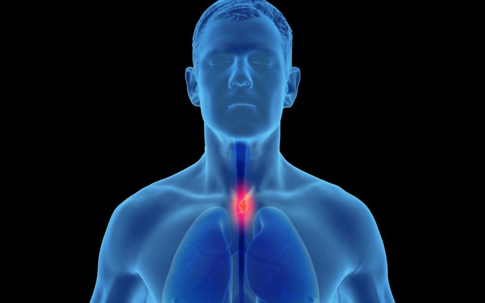 Swallowing Difficulty? Is it Eosinophilic Esophagitis?