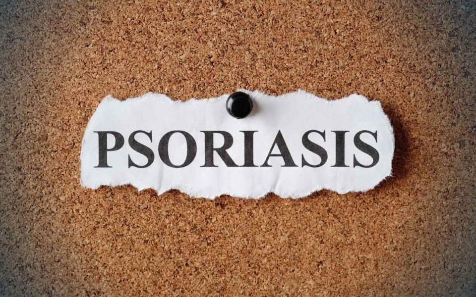 Getting to the Root of Psoriasis